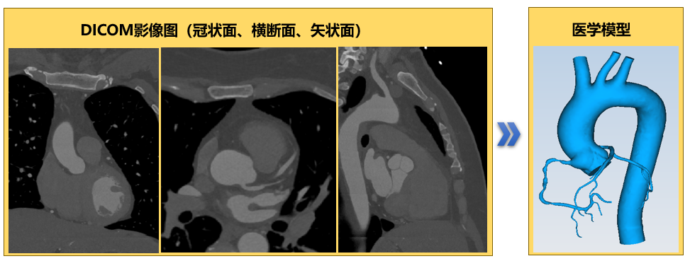 冠状动脉搭桥手术虚拟仿真APP助力精准外科
的图3